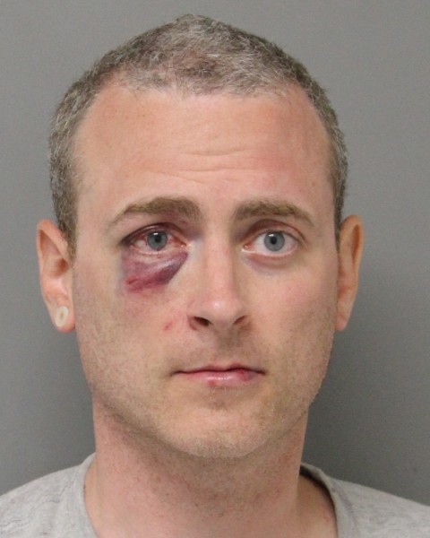 Road rage leads to black eye, felony charges for NY man Road rage leads to black eye, felony charges for NY man