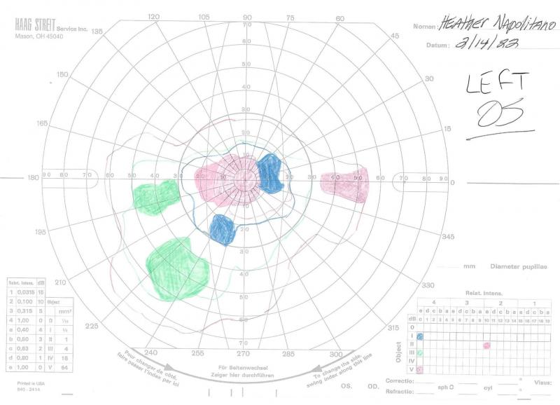 The diagram from Napolitano’s most recent visual field test shows colored circles depicting different levels of blind spots, where she has little to no vision. All blind spots are in the center of her retina.